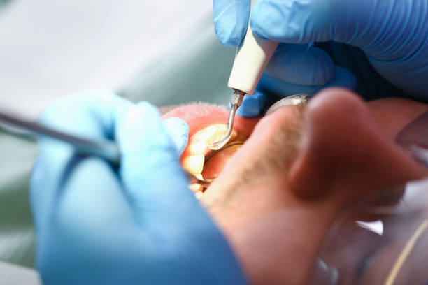 Best Emergency Treatment for Toothache in White Sulphur Springs, WV