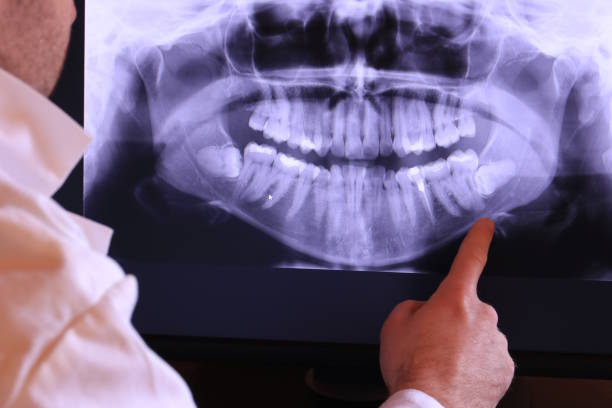 Best Emergency Treatment for Toothache in White Sulphur Springs, WV