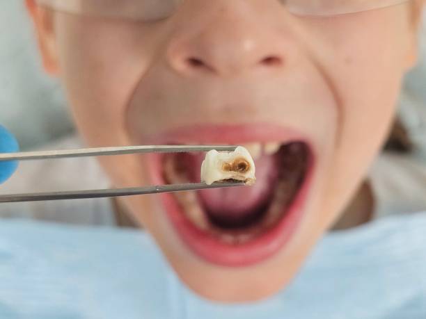 Best Emergency Dental Care for Trauma or Injury in White Sulphur Springs, WV