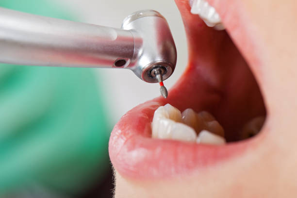 Best Same-Day Emergency Dentist in White Sulphur Springs, WV